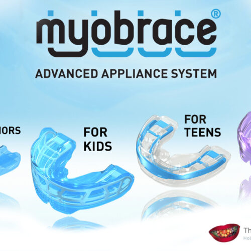 Myobrace-hove-brighton-uk