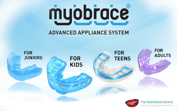 Myobrace-hove-brighton-uk-585